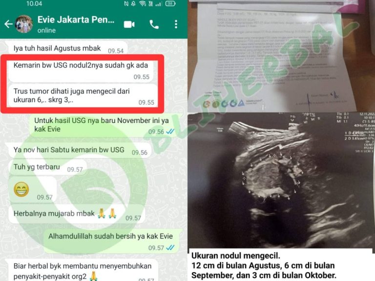 Gambar-WhatsApp-2024-01-15-pukul-12.05.21_1ce3937c111111-1024x768-1-768x576-1