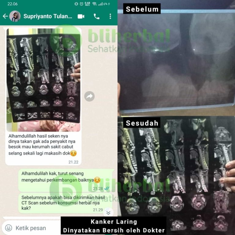 Gambar-WhatsApp-2024-01-15-pukul-12.05.21_8d20f07f5555555-1024x1024-1-768x768-1